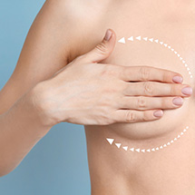 Dr Elias Moustakis - Treatment, Breast Lift