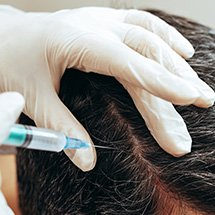 Dr Elias Moustakis - Treatment, Hair Transplant